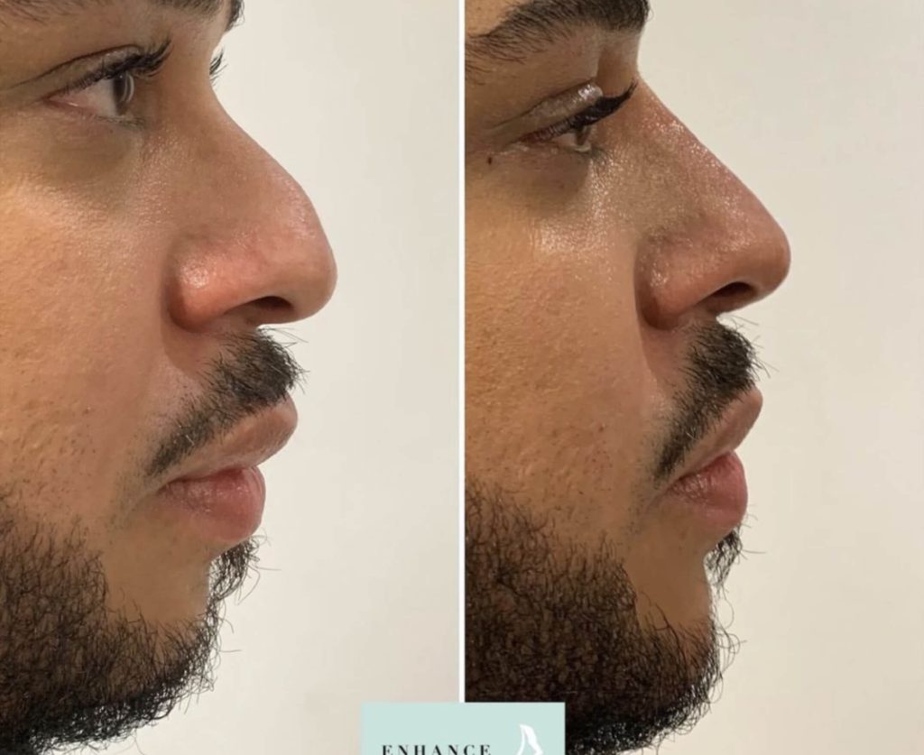 Dr Tara Francis Twoth Dental + Facial Aesthetics